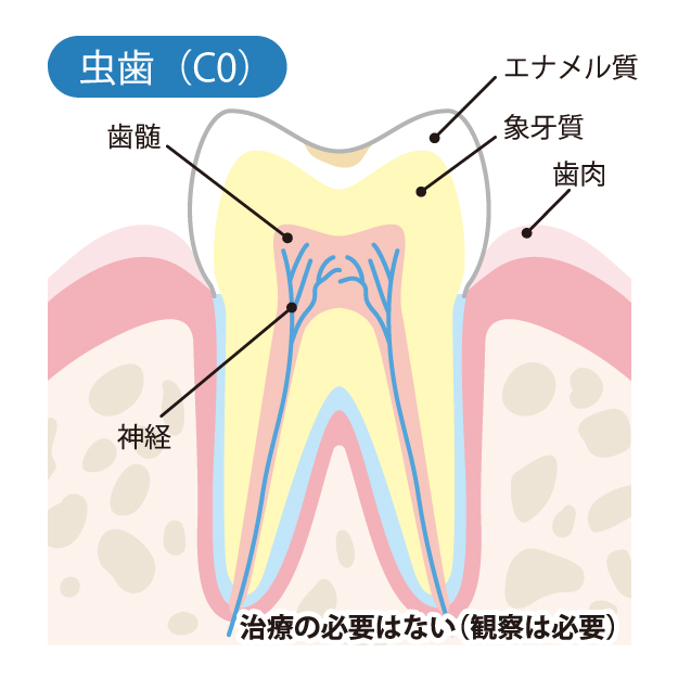 愛媛県松山市の歯医者、つばき歯科クリニックの一般歯科治療